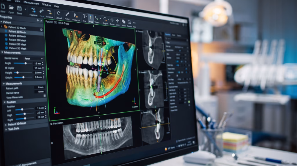 3D snimak implant cena | Ada Dent stomatoloska ordinacija